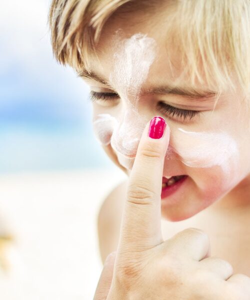 Sunburn in adults and children